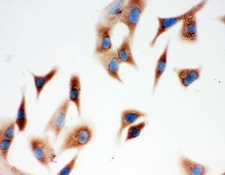 Invitrogen Annexin A3 Polyclonal Antibody 100 &mu;g | Buy Online | Invitrogen&trade; | Fisher Scientific