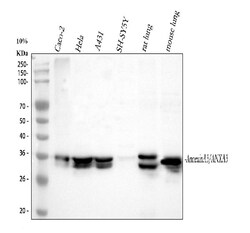 Invitrogen Annexin A3 Polyclonal Antibody 100 &mu;g | Buy Online | Invitrogen&trade; | Fisher Scientific