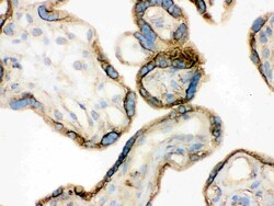 Invitrogen Annexin A3 Polyclonal Antibody 100 &mu;g | Buy Online | Invitrogen&trade; | Fisher Scientific