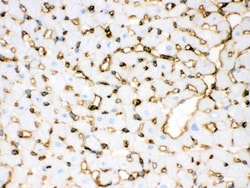Invitrogen Annexin A3 Polyclonal Antibody 100 &mu;g | Buy Online | Invitrogen&trade; | Fisher Scientific