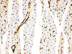 Invitrogen Annexin A3 Polyclonal Antibody 100 &mu;g | Buy Online | Invitrogen&trade; | Fisher Scientific