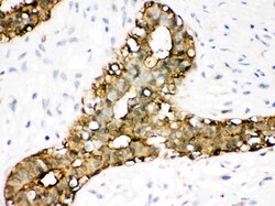 Invitrogen Annexin A3 Polyclonal Antibody 100 &mu;g | Buy Online | Invitrogen&trade; | Fisher Scientific