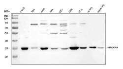 Invitrogen Annexin A4 Polyclonal Antibody 100 &mu;g | Buy Online | Invitrogen&trade; | Fisher Scientific