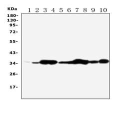 Invitrogen Annexin V Polyclonal Antibody 100 &mu;g | Buy Online | Invitrogen&trade; | Fisher Scientific