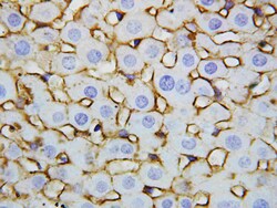 Invitrogen Annexin V Polyclonal Antibody 100 &mu;g | Buy Online | Invitrogen&trade; | Fisher Scientific