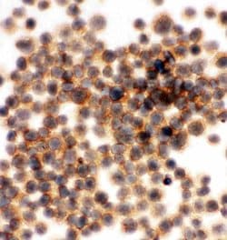 Invitrogen RIAM Polyclonal Antibody 100 &mu;g; Unconjugated:Antibodies,
