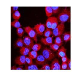 Invitrogen RIAM Polyclonal Antibody 100 &mu;g; Unconjugated:Antibodies,