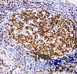 Invitrogen RIAM Polyclonal Antibody 100 &mu;g; Unconjugated:Antibodies,