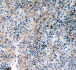 Invitrogen RIAM Polyclonal Antibody 100 &mu;g; Unconjugated:Antibodies,