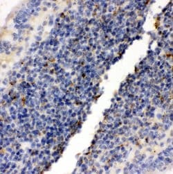 Invitrogen RIAM Polyclonal Antibody 100 &mu;g; Unconjugated:Antibodies,