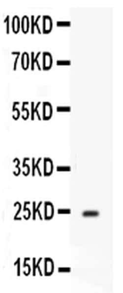 Invitrogen ApoA1 Polyclonal Antibody 100 &mu;g; Unconjugated:Antibodies,