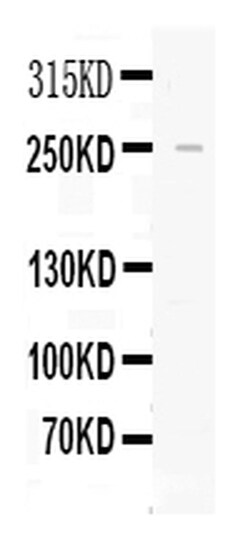 Invitrogen Apolipoprotein B Polyclonal Antibody 100 &mu;g; Unconjugated:Antibodies,