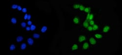 Invitrogen APRT Polyclonal Antibody 100 &mu;g; Unconjugated:Antibodies,