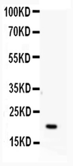 Invitrogen APRT Polyclonal Antibody 100 &mu;g; Unconjugated:Antibodies,