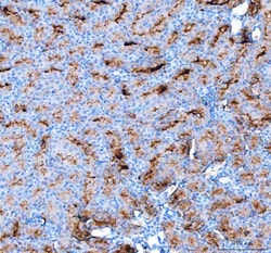 Invitrogen Aquaporin 1 Polyclonal Antibody 100 &mu;g; Unconjugated:Antibodies,
