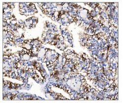 Invitrogen Aquaporin 1 Polyclonal Antibody 100 &mu;g; Unconjugated:Antibodies,