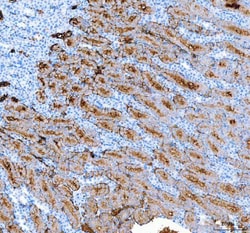 Invitrogen Aquaporin 1 Polyclonal Antibody 100 &mu;g; Unconjugated:Antibodies,