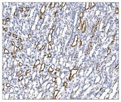 Invitrogen Aquaporin 1 Polyclonal Antibody 100 &mu;g; Unconjugated:Antibodies,