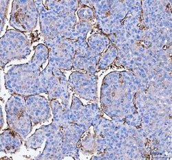 Invitrogen Aquaporin 1 Polyclonal Antibody 100 &mu;g; Unconjugated:Antibodies,