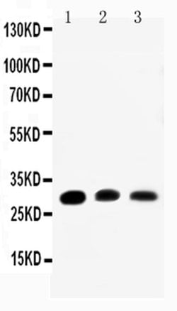 Invitrogen Aquaporin 1 Polyclonal Antibody 100 &mu;g; Unconjugated:Antibodies,