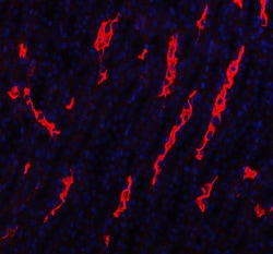 Invitrogen&trade;&nbsp;Aquaporin 1 Polyclonal Antibody