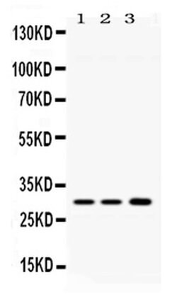 Invitrogen AQP11 Polyclonal Antibody 100 &mu;g; Unconjugated:Antibodies,