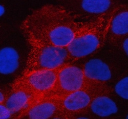 Invitrogen Aquaporin 3 Polyclonal Antibody 100 &mu;g; Unconjugated:Antibodies,