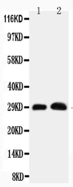 Invitrogen Aquaporin 5 Polyclonal Antibody 100 &mu;g; Unconjugated:Antibodies,