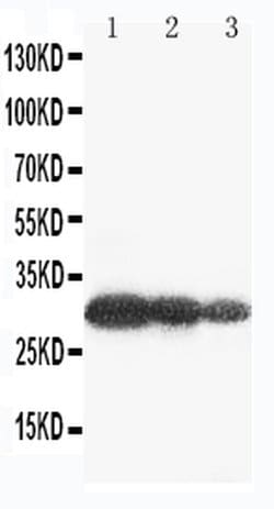 Invitrogen Aquaporin 6 Polyclonal Antibody 100 &mu;g; Unconjugated:Antibodies,