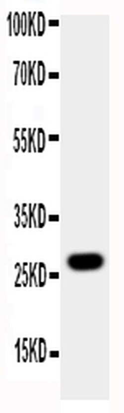 Invitrogen Aquaporin 8 Polyclonal Antibody 100 &mu;g; Unconjugated:Antibodies,