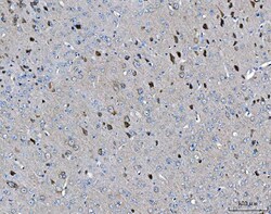 Invitrogen ARFGAP1 Polyclonal Antibody 100 &mu;g; Unconjugated:Antibodies,