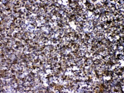 Invitrogen ARHGEF1 Polyclonal Antibody 100 &mu;g | Buy Online | Invitrogen&trade; | Fisher Scientific