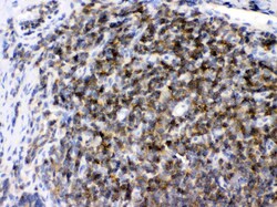 Invitrogen ARHGEF1 Polyclonal Antibody 100 &mu;g | Buy Online | Invitrogen&trade; | Fisher Scientific