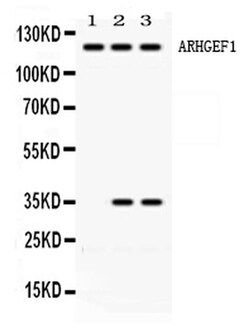 Invitrogen ARHGEF1 Polyclonal Antibody 100 &mu;g | Buy Online | Invitrogen&trade; | Fisher Scientific