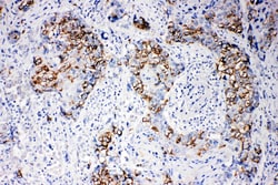 Invitrogen beta Arrestin 1 Polyclonal Antibody 100 &mu;g | Buy Online | Invitrogen&trade; | Fisher Scientific