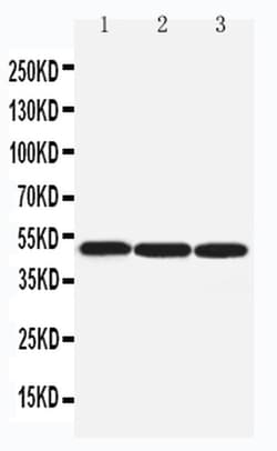 Invitrogen beta Arrestin 1 Polyclonal Antibody 100 &mu;g | Buy Online | Invitrogen&trade; | Fisher Scientific