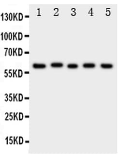 Invitrogen ASIC3 Polyclonal Antibody 100 &mu;g; Unconjugated:Antibodies,