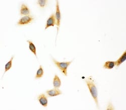 Invitrogen ASPH Polyclonal Antibody 100 &mu;g; Unconjugated:Antibodies,
