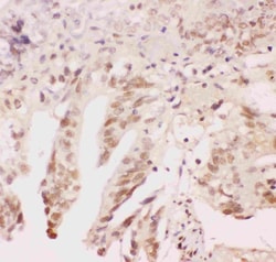 Invitrogen ATF1 Polyclonal Antibody 100 &mu;g; Unconjugated:Antibodies,