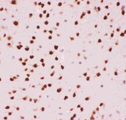 Invitrogen ATF2 Polyclonal Antibody 100 &mu;g; Unconjugated:Antibodies,