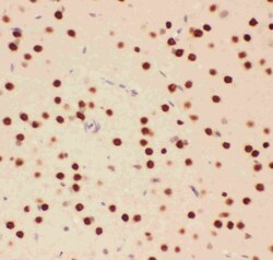 Invitrogen ATF2 Polyclonal Antibody 100 &mu;g; Unconjugated:Antibodies,
