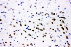Invitrogen ATF2 Polyclonal Antibody 100 &mu;g; Unconjugated:Antibodies,
