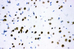 Invitrogen ATF2 Polyclonal Antibody 100 &mu;g; Unconjugated:Antibodies,