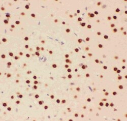 Invitrogen ATF2 Polyclonal Antibody 100 &mu;g; Unconjugated:Antibodies,