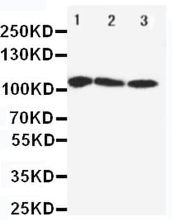 Invitrogen SERCA1 ATPase Polyclonal Antibody 100 &mu;g; Unconjugated:Antibodies,