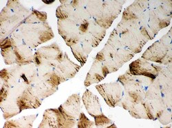 Invitrogen SERCA1 ATPase Polyclonal Antibody 100 &mu;g; Unconjugated:Antibodies,
