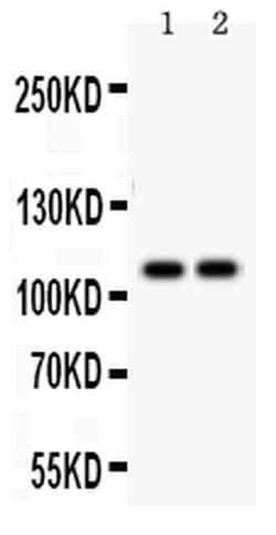 Invitrogen SERCA1 ATPase Polyclonal Antibody 100 &mu;g; Unconjugated:Antibodies,