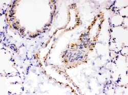 Invitrogen SERCA2 ATPase Polyclonal Antibody 100 &mu;g; Unconjugated:Antibodies,
