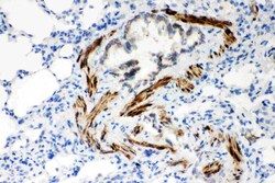 Invitrogen SERCA2 ATPase Polyclonal Antibody 100 &mu;g; Unconjugated:Antibodies,
