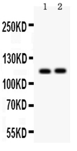 Invitrogen SERCA2 ATPase Polyclonal Antibody 100 &mu;g; Unconjugated:Antibodies,